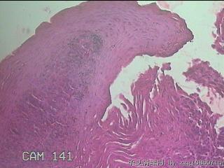 上段食管粘膜图18