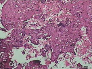 胎盘图22