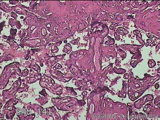 胎盘图13