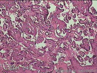 胎盘图38
