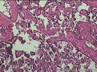 胎盘图44