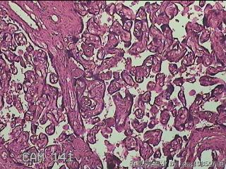 胎盘图37