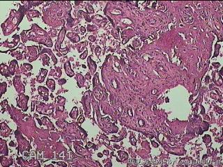 胎盘图43