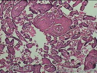 胎盘图26