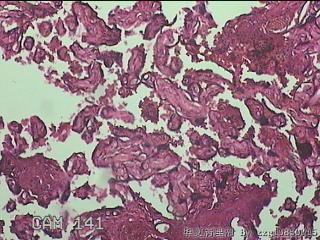 胎盘图36