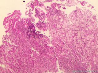 胃窦组织重切片图4
