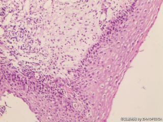 宫颈组织图7