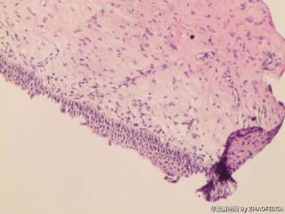 宫颈活检组织图8