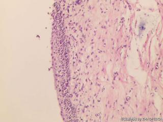 宫颈活检组织图7