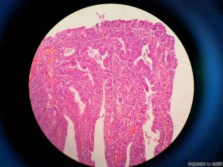 直肠活检图10