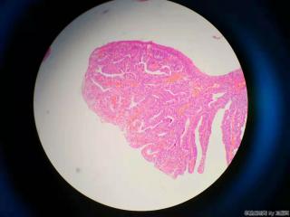 直肠活检图11