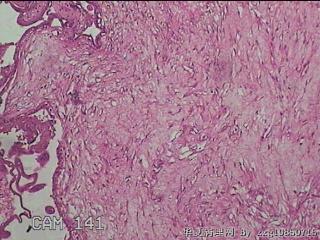 宫腔組织图26