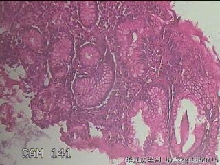 胃体中部粘膜图11