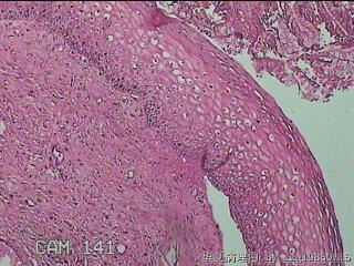 宫颈组织图24