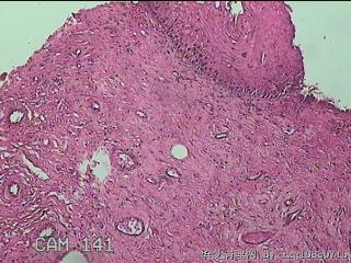 宫颈组织图19