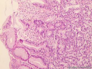 胃底组织图13