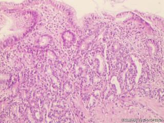 胃底组织图6