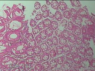 直肠粘膜图11