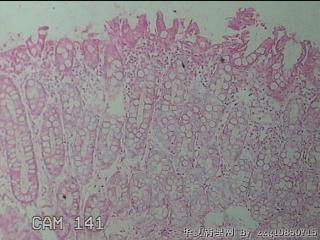 直肠粘膜图5