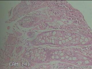 直肠粘膜图14