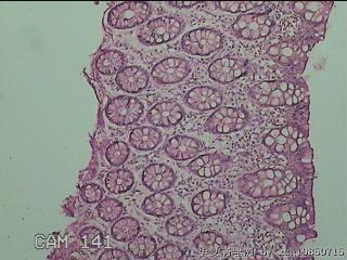 降结肠粘膜图3