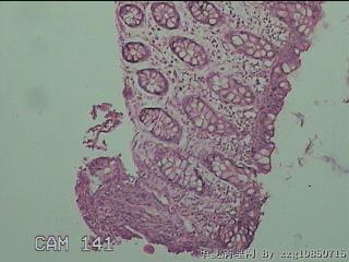 降结肠粘膜图1