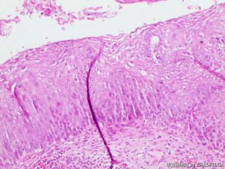 宫颈组织图10