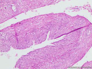 宫颈组织图14