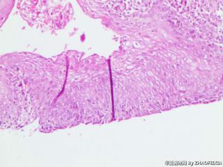 宫颈组织图13