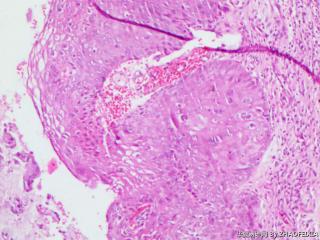 宫颈组织图7