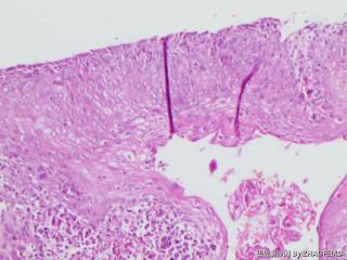 宫颈组织图12