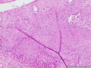 宫颈组织图11