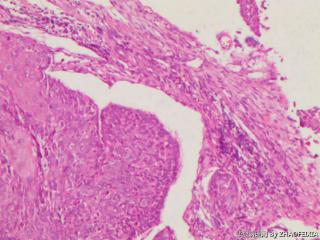 宫颈组织图11