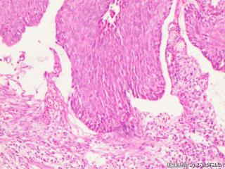 宫颈组织图6
