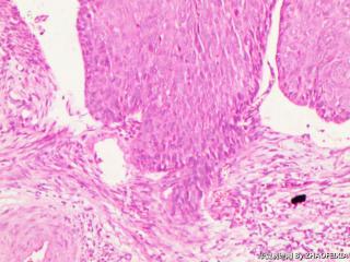 宫颈组织图5