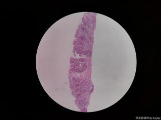 内镜活检图8