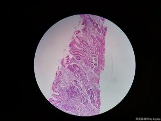内镜活检图11