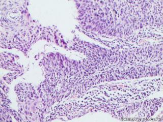 宫颈活检组织图7