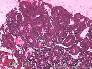 横结肠粘膜图4