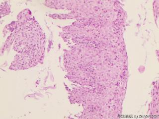宫颈组织图8