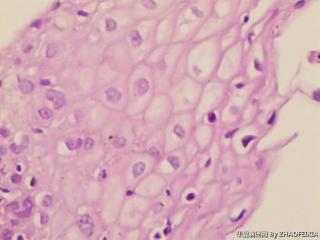 宫颈组织图25