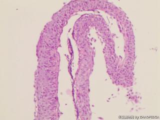 宫颈组织图7