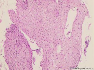 宫颈组织图11