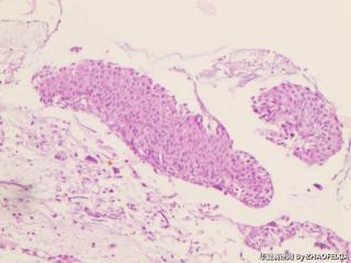 宫颈组织图5