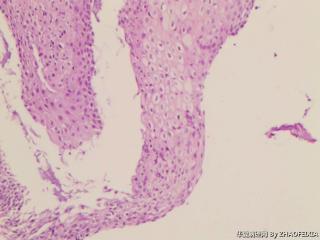 宫颈组织图10