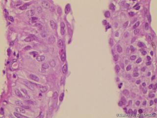 宫颈组织图22