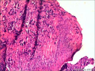 贲门活检组织图5
