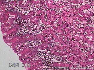 幽门管粘膜图2