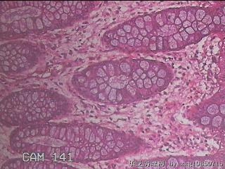 直乙结肠粘膜图15