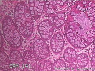 直乙结肠粘膜图29